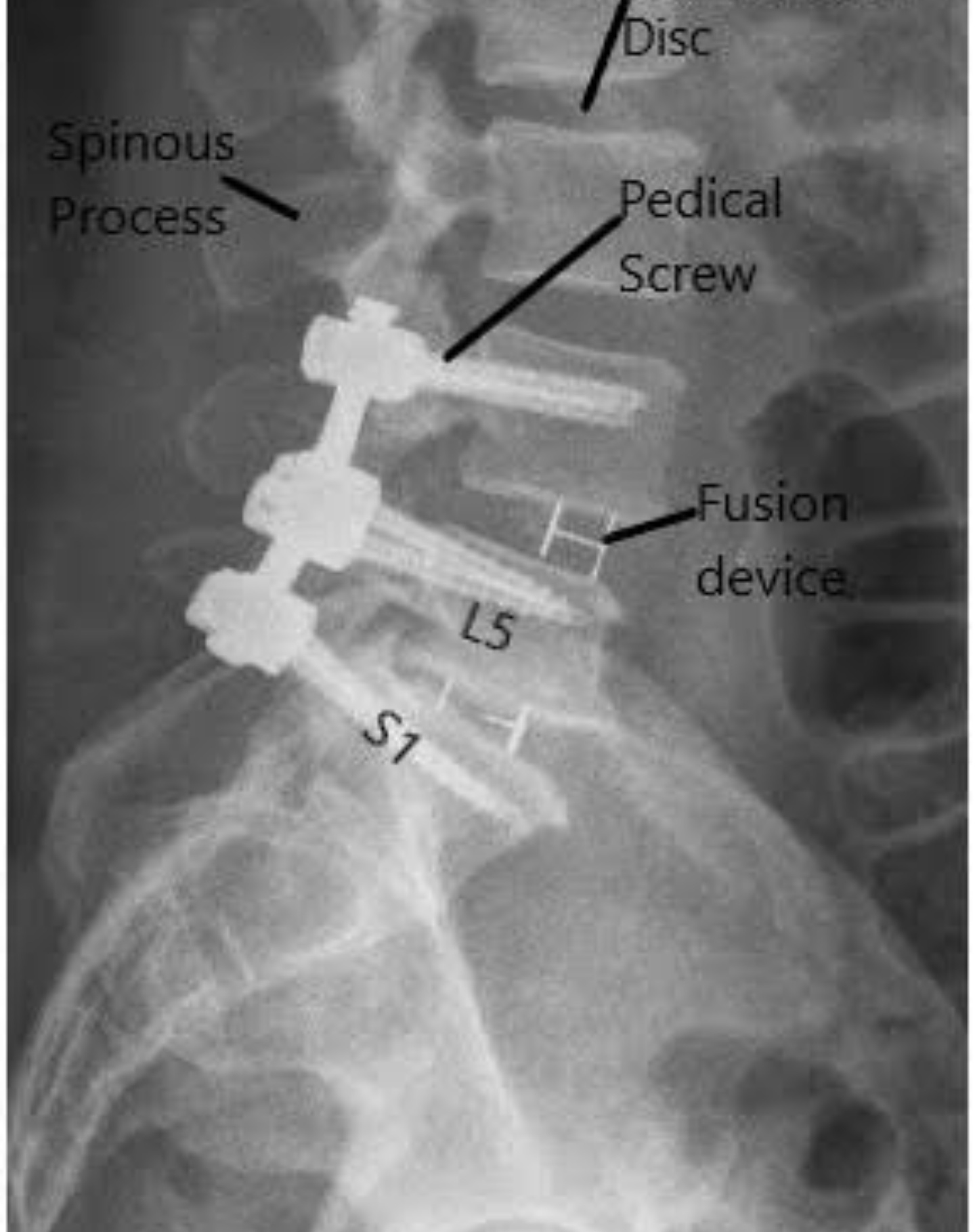 SPINE DISORDER MANAGEMENT