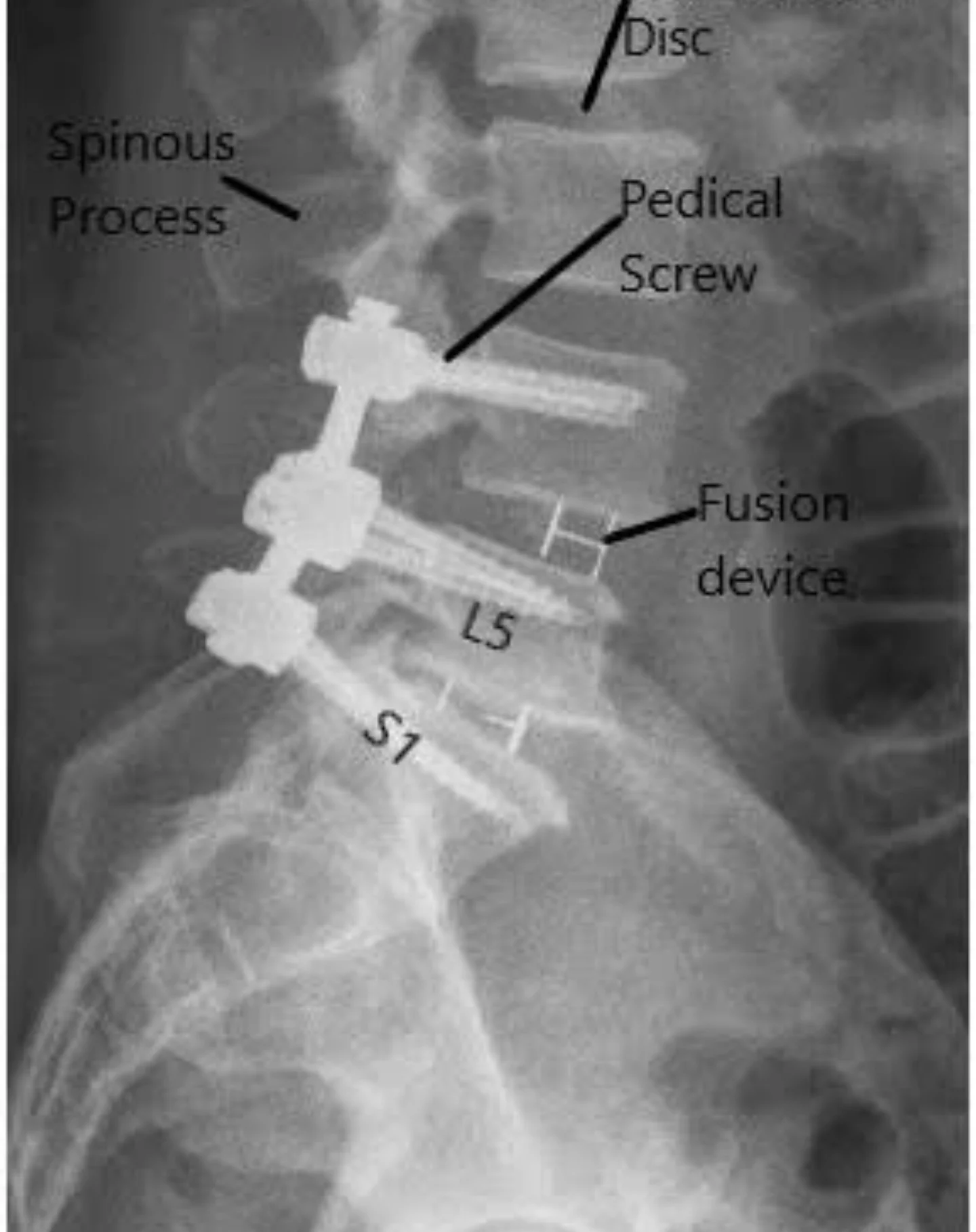 SPINE DISORDER MANAGEMENT